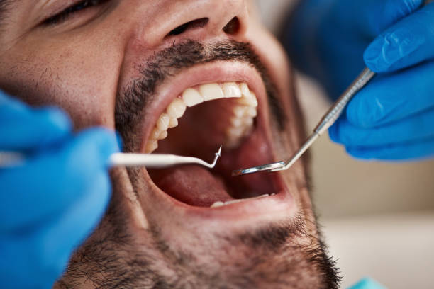 Best Dental Abscess Treatment in Monticello, MS